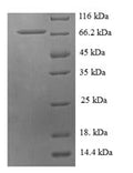 Recombinant Human Probable histidine--tRNA ligase, mitochondrial (HARS2) – Figure 1 of 1