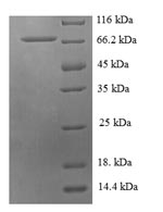 Recombinant Human Probable histidine--tRNA ligase, mitochondrial (HARS2) – Figure 1 of 1