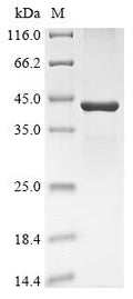 (Tris-Glycine gel) Discontinuous SDS-PAGE (reduced) with 5% enrichment gel and 15% separation gel.