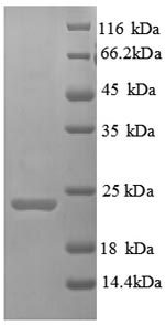 Recombinant Human Hepatitis A virus cellular receptor 2 (HAVCR2), partial – Figure 1 of 1
