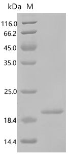 Recombinant Human Ragulator complex protein LAMTOR5 (LAMTOR5) – Figure 1 of 1