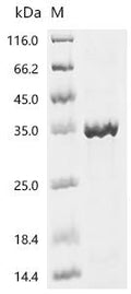 (Tris-Glycine gel) Discontinuous SDS-PAGE (reduced) with 5% enrichment gel and 15% separation gel.