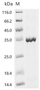 (Tris-Glycine gel) Discontinuous SDS-PAGE (reduced) with 5% enrichment gel and 15% separation gel.