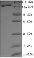 Recombinant Human Histone deacetylase 1 (HDAC1) – Figure 1 of 1