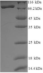 Recombinant Human Histone deacetylase 1 (HDAC1) – Figure 1 of 1