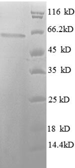 Recombinant Human Histone deacetylase 3 (HDAC3) – Figure 1 of 1