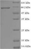 Recombinant Human Histone deacetylase 8 (HDAC8) – Figure 1 of 1