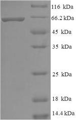 Recombinant Human Histone deacetylase 8 (HDAC8) – Figure 1 of 1