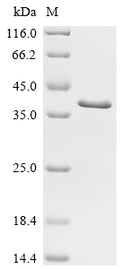 Recombinant Human Vigilin (HDLBP), partial – Figure 1 of 1