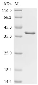 Recombinant Human Vigilin (HDLBP), partial – Figure 1 of 1