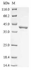 (Tris-Glycine gel) Discontinuous SDS-PAGE (reduced) with 5% enrichment gel and 15% separation gel.