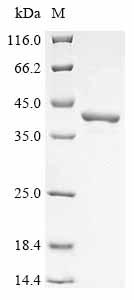(Tris-Glycine gel) Discontinuous SDS-PAGE (reduced) with 5% enrichment gel and 15% separation gel.