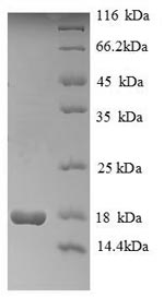 Recombinant Human Histone H2A type 1 (HIST1H2AG) – Figure 1 of 1