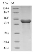 (Tris-Glycine gel) Discontinuous SDS-PAGE (reduced) with 5% enrichment gel and 15% separation gel.