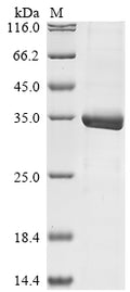 (Tris-Glycine gel) Discontinuous SDS-PAGE (reduced) with 5% enrichment gel and 15% separation gel.