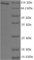 Recombinant Human Holliday junction recognition protein (HJURP) – Figure 1 of 1