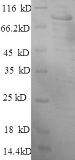 Recombinant Human Hexokinase-1 (HK1) – Figure 1 of 1