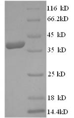 Recombinant Human 3-hydroxy-3-methylglutaryl-coenzyme A reductase (HMGCR), partial – Figure 1 of 1