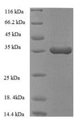Recombinant Human Heme oxygenase 1 (HMOX1), partial – Figure 1 of 1