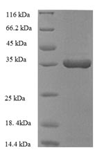 Recombinant Human Heme oxygenase 1 (HMOX1), partial – Figure 1 of 1