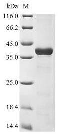 (Tris-Glycine gel) Discontinuous SDS-PAGE (reduced) with 5% enrichment gel and 15% separation gel.