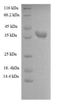 Recombinant Human Heterogeneous nuclear ribonucleoprotein A1 (HNRNPA1), partial – Figure 1 of 1