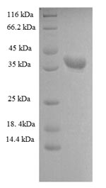Recombinant Human Heterogeneous nuclear ribonucleoprotein A1 (HNRNPA1), partial – Figure 1 of 1
