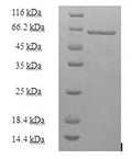 Recombinant Human Heterogeneous nuclear ribonucleoprotein H (HNRNPH1) – Figure 1 of 1