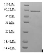 Recombinant Human Heterogeneous nuclear ribonucleoprotein H (HNRNPH1) – Figure 1 of 1