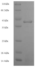 Recombinant Human Heterogeneous nuclear ribonucleoprotein L (HNRNPL), partial – Figure 1 of 1