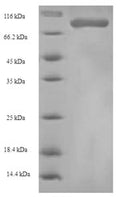 Recombinant Human Heterogeneous nuclear ribonucleoprotein L (HNRNPL) – Figure 1 of 1