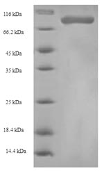 Recombinant Human Heterogeneous nuclear ribonucleoprotein L (HNRNPL) – Figure 1 of 1