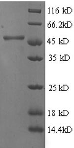 Recombinant Human 4-hydroxyphenylpyruvate dioxygenase (HPD) – Figure 1 of 1