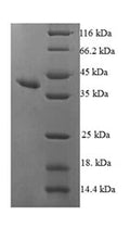 Recombinant Human Ribonuclease UK114 (HRSP12) – Figure 1 of 1