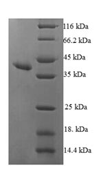 Recombinant Human Ribonuclease UK114 (HRSP12) – Figure 1 of 1