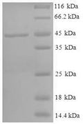 Recombinant Human 11-beta-hydroxysteroid dehydrogenase 1 (HSD11B1), partial – Figure 1 of 1