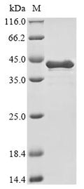 (Tris-Glycine gel) Discontinuous SDS-PAGE (reduced) with 5% enrichment gel and 15% separation gel.