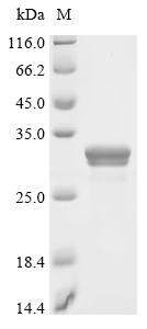(Tris-Glycine gel) Discontinuous SDS-PAGE (reduced) with 5% enrichment gel and 15% separation gel.