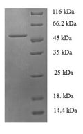 Recombinant Human Checkpoint protein HUS1 (HUS1), partial – Figure 1 of 1