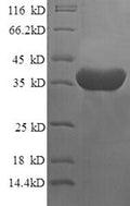 Recombinant Human Islet cell autoantigen 1 (ICA1), partial – Figure 1 of 1