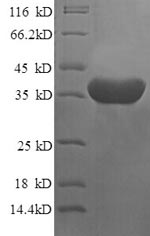 Recombinant Human Islet cell autoantigen 1 (ICA1), partial – Figure 1 of 1