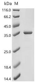 (Tris-Glycine gel) Discontinuous SDS-PAGE (reduced) with 5% enrichment gel and 15% separation gel.