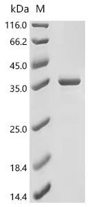 (Tris-Glycine gel) Discontinuous SDS-PAGE (reduced) with 5% enrichment gel and 15% separation gel.