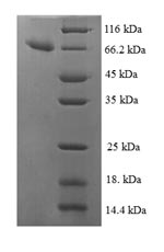 Recombinant Human Isocitrate dehydrogenase [NAD] subunit beta, mitochondrial (IDH3B) – Figure 1 of 1