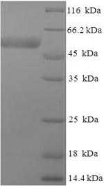 Recombinant Human Isocitrate dehydrogenase [NAD] subunit gamma, mitochondrial (IDH3G) – Figure 1 of 1