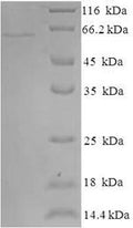 Recombinant Human Indoleamine 2,3-dioxygenase 2 (IDO2) – Figure 1 of 1