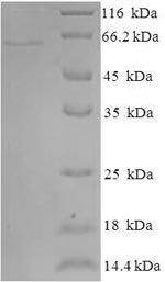 Recombinant Human Indoleamine 2,3-dioxygenase 2 (IDO2) – Figure 1 of 1