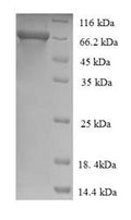Recombinant Human Alpha-L-iduronidase (IDUA) – Figure 1 of 1