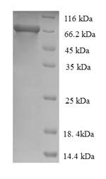 Recombinant Human Alpha-L-iduronidase (IDUA) – Figure 1 of 1