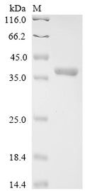 (Tris-Glycine gel) Discontinuous SDS-PAGE (reduced) with 5% enrichment gel and 15% separation gel.
